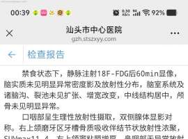 肺癌晚期要配合放疗吗