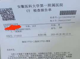 怎么用药和治疗？