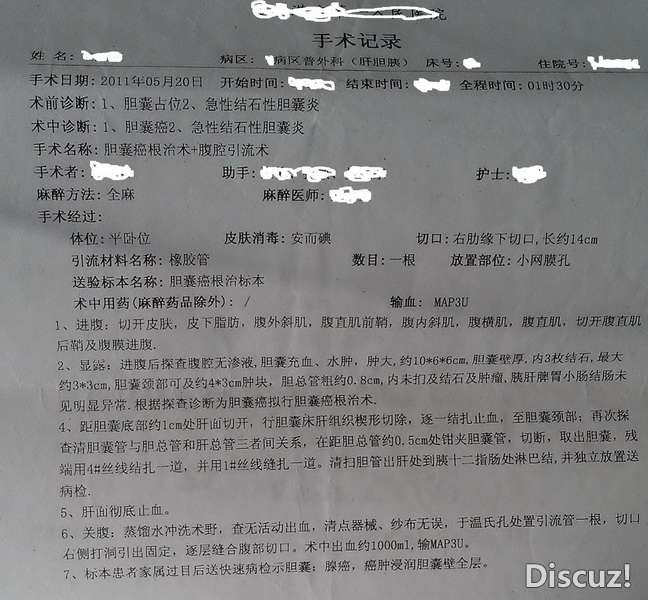 11年5月一直疼，到乡下医院说是胆结石要开刀，直接到市里的医院，一检查胆囊癌