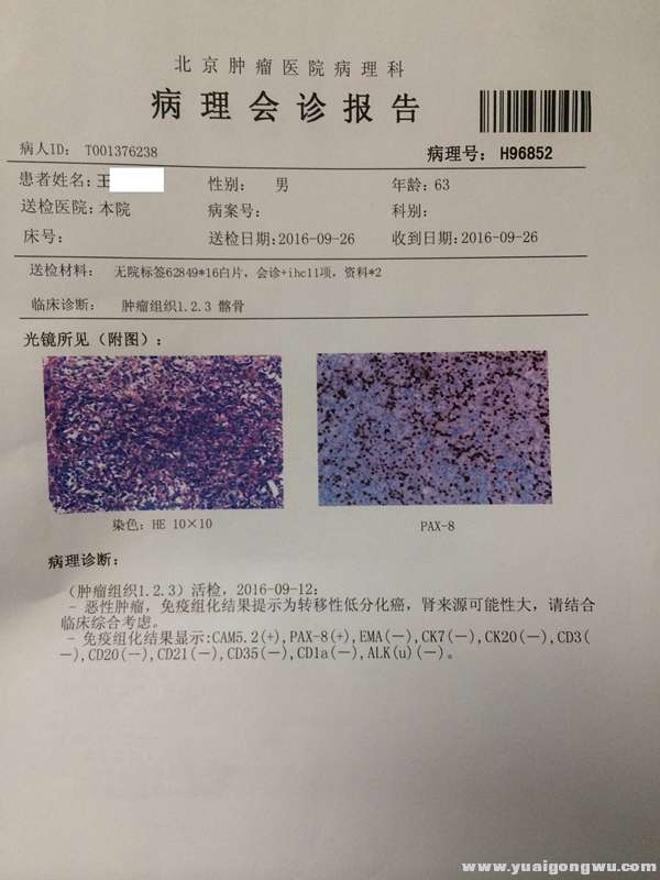 北大肿瘤医院病理