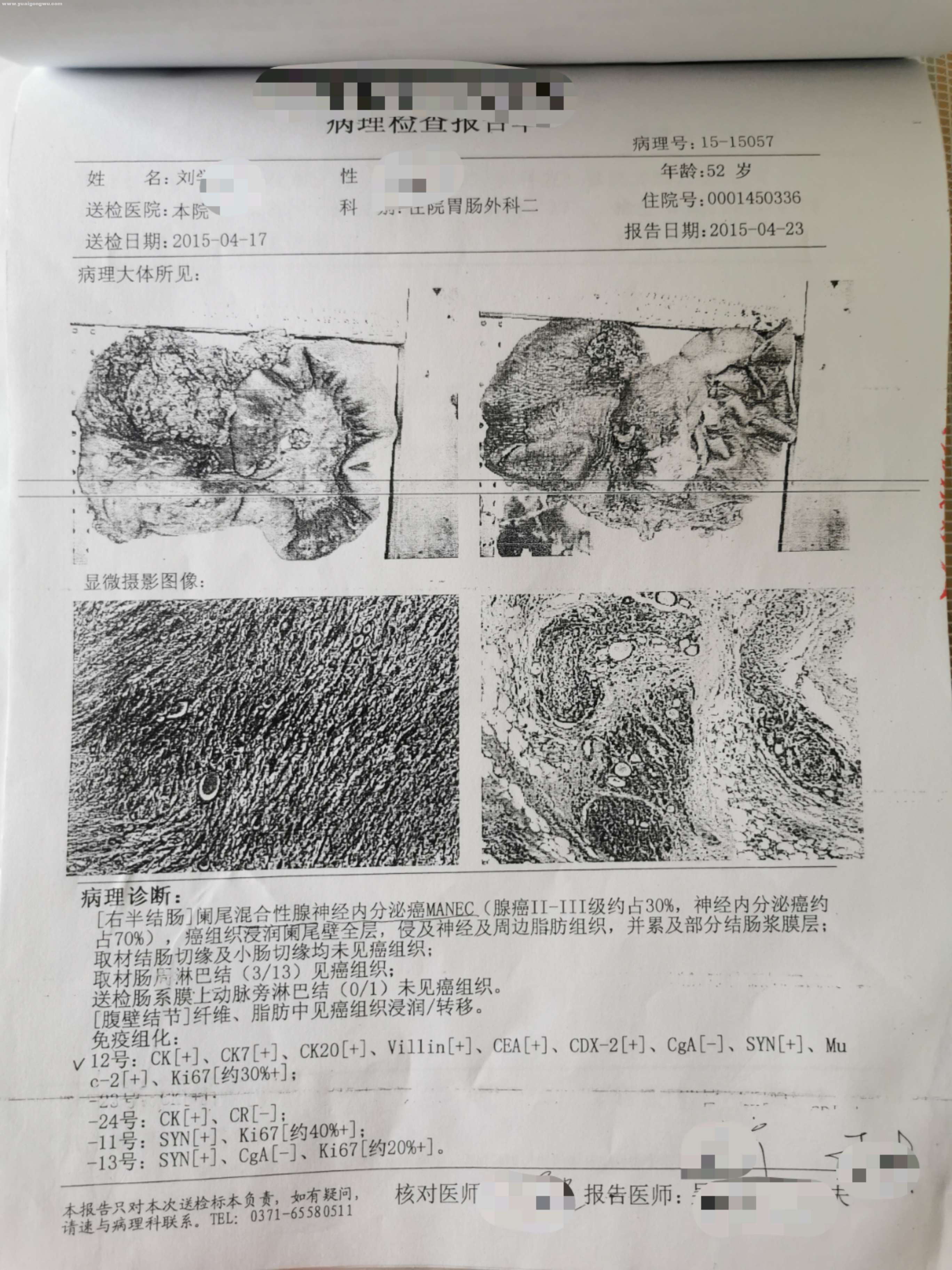 2015年病理报告