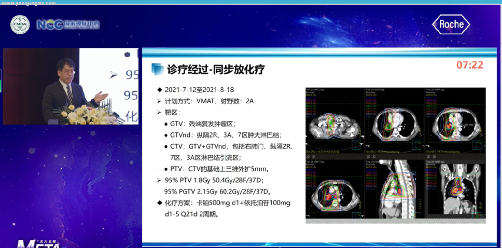 复发后同步放化疗1.png